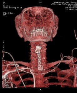 Full frontal